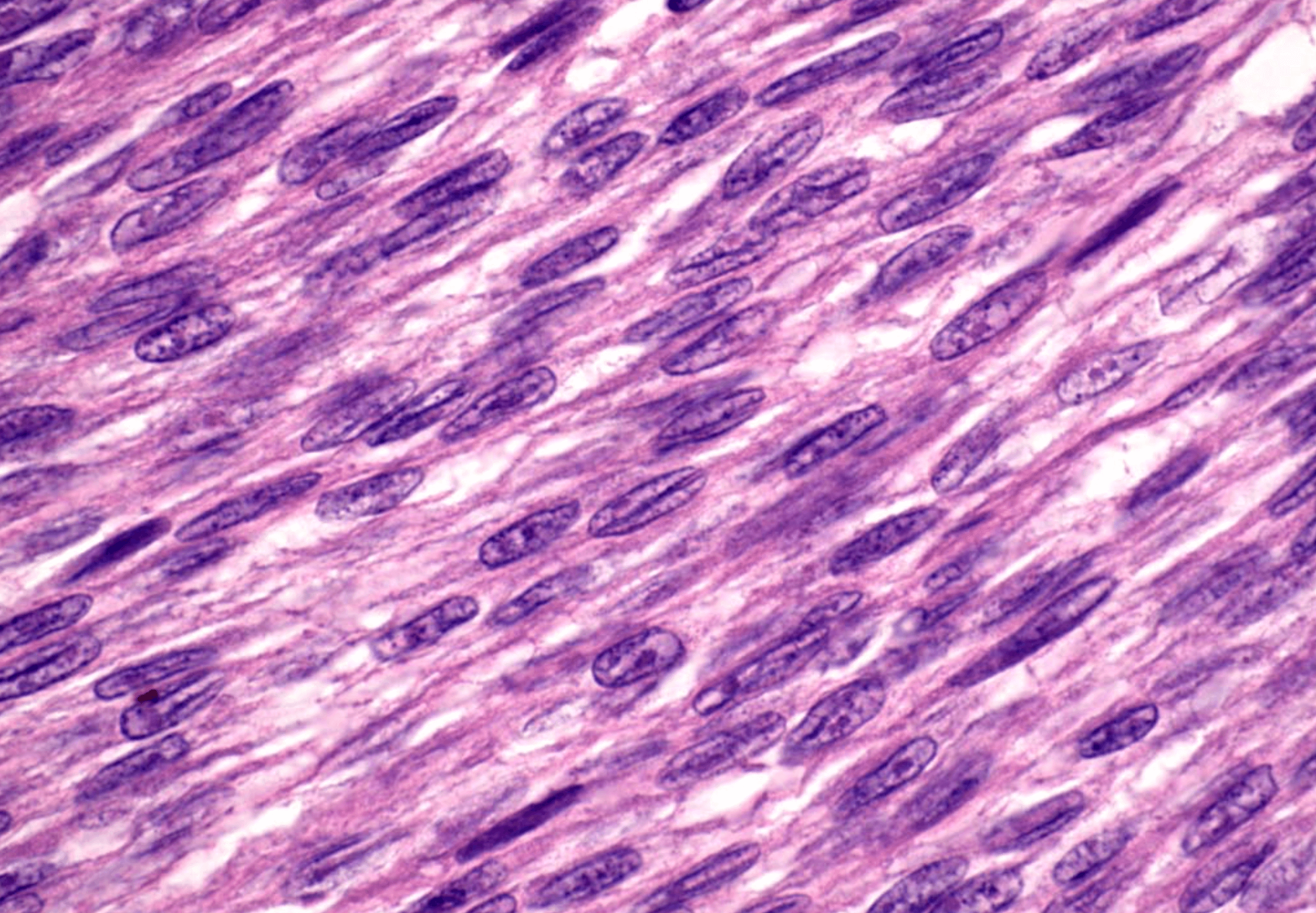 Image is not available