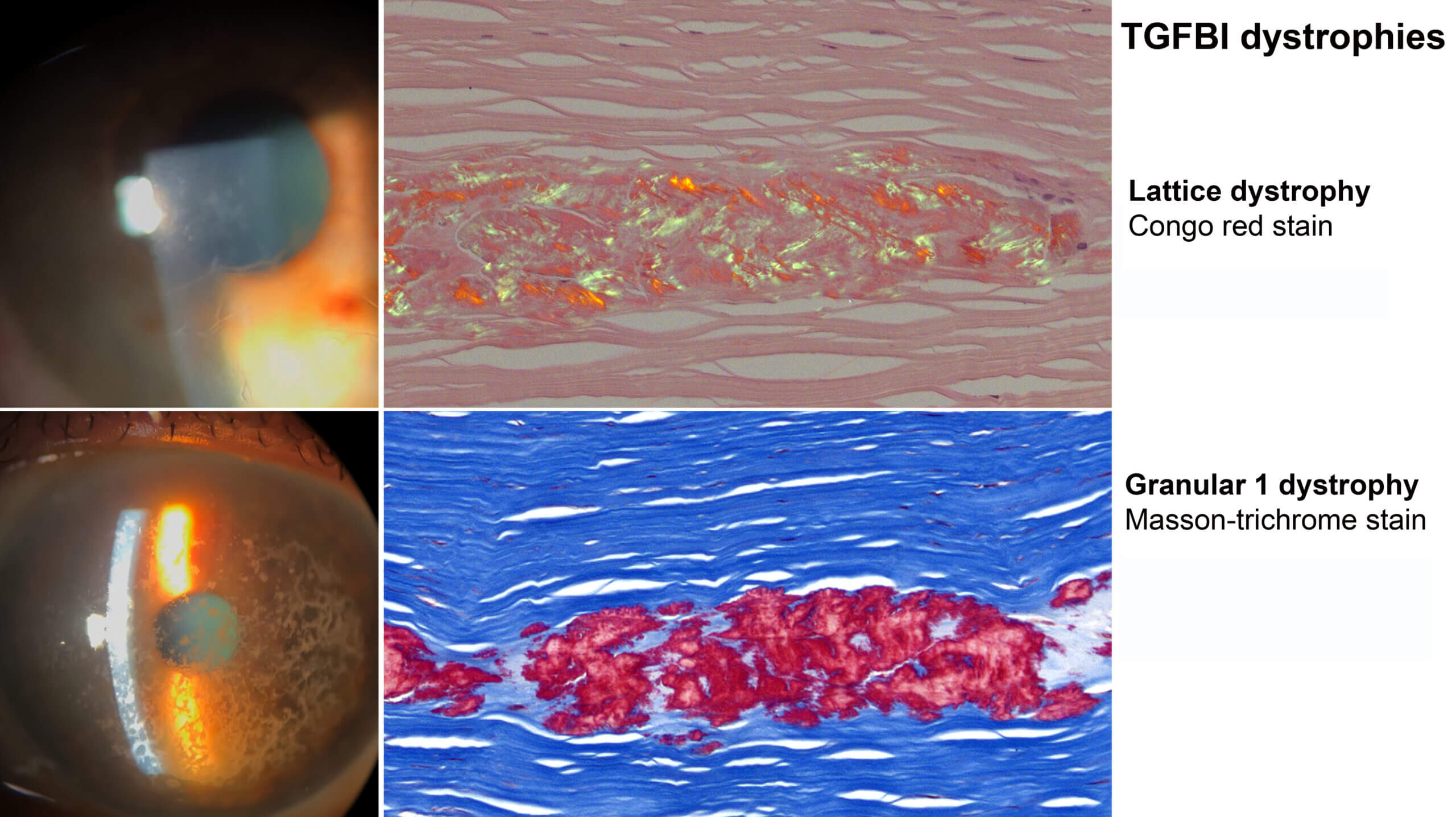 Tatyana Milman, MD, Ocular Pathology