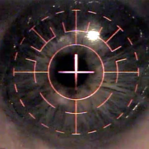 This is an image taken during a LASIK Procedure