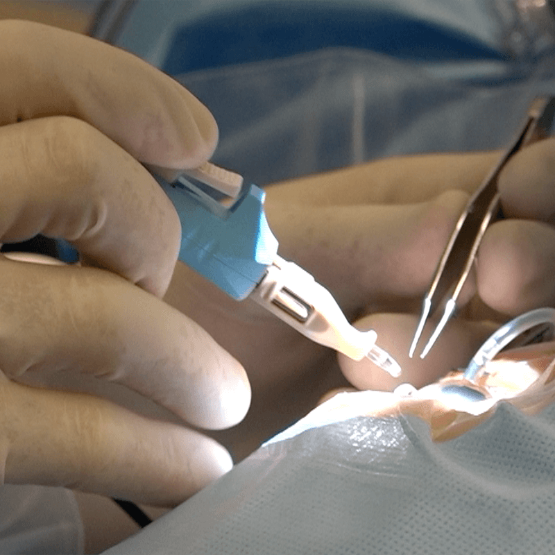 Surgery image