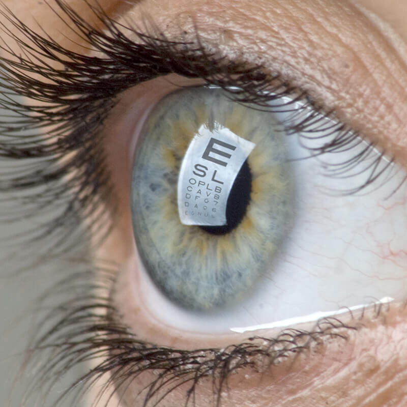 Cataract Surgery