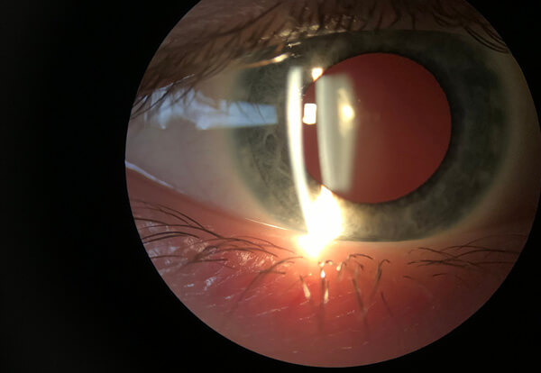 Best Ophthalmology Hospitals